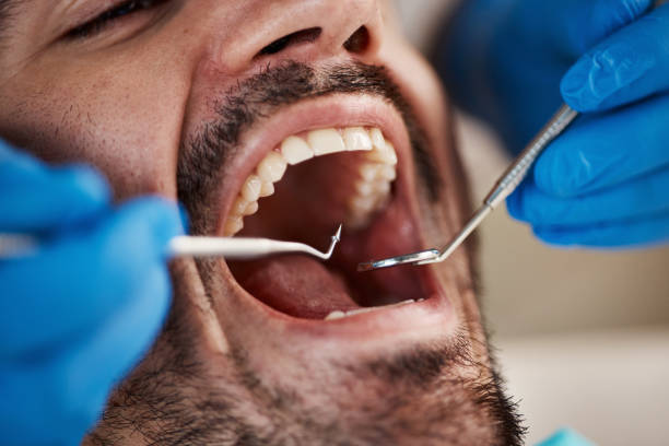 Best Emergency Tooth Extraction  in Milan, IN